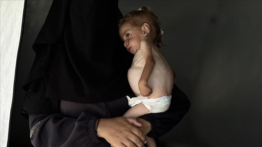 والدة الطفلة شام  أنجبتها بعد 9 سنوات من التعب والعلاج واليوم أخشى أن أفقدها 