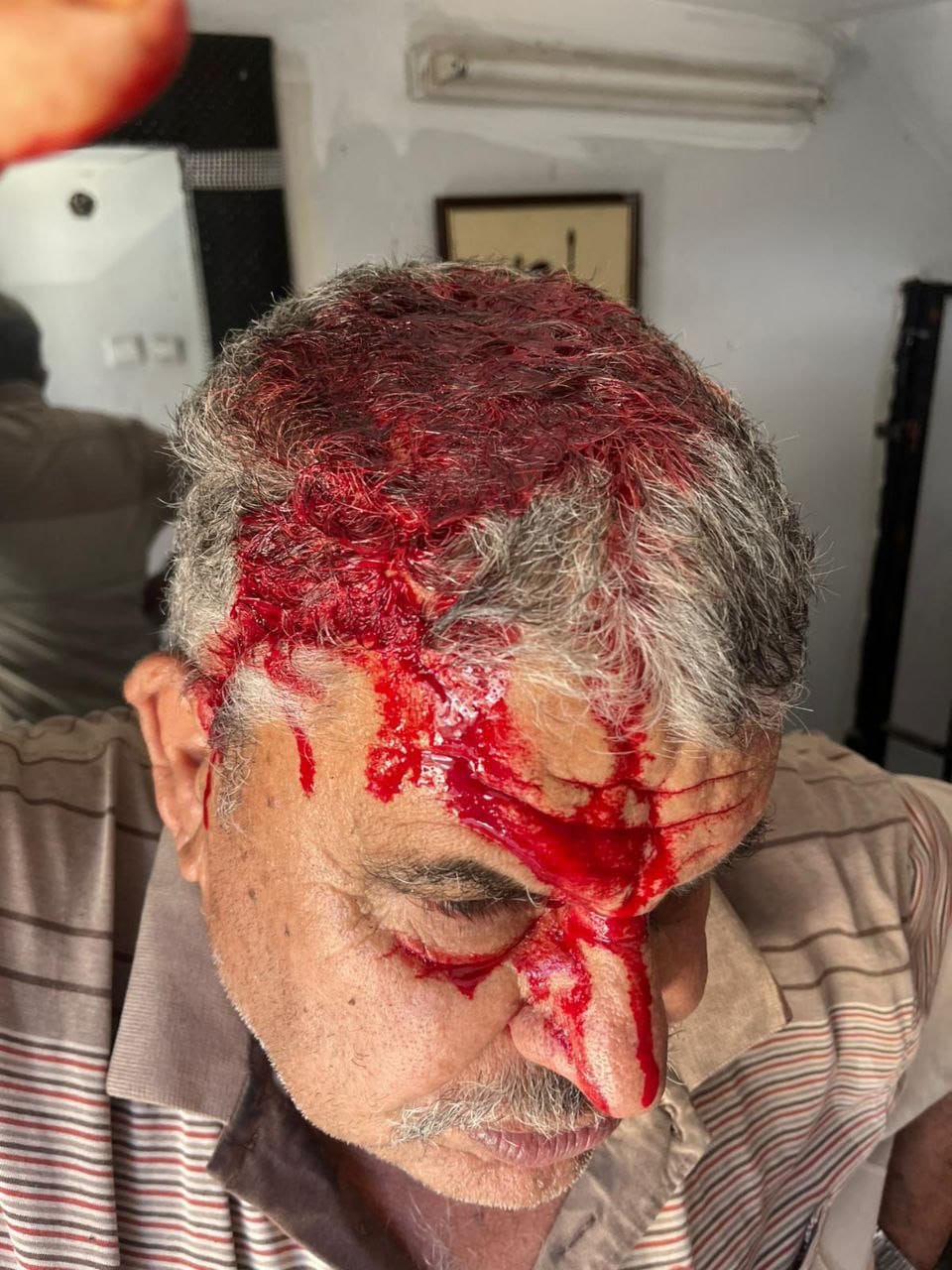 إصابة مواطن بجروح جراء اعتداء مستوطنين في عصيرة القبلية