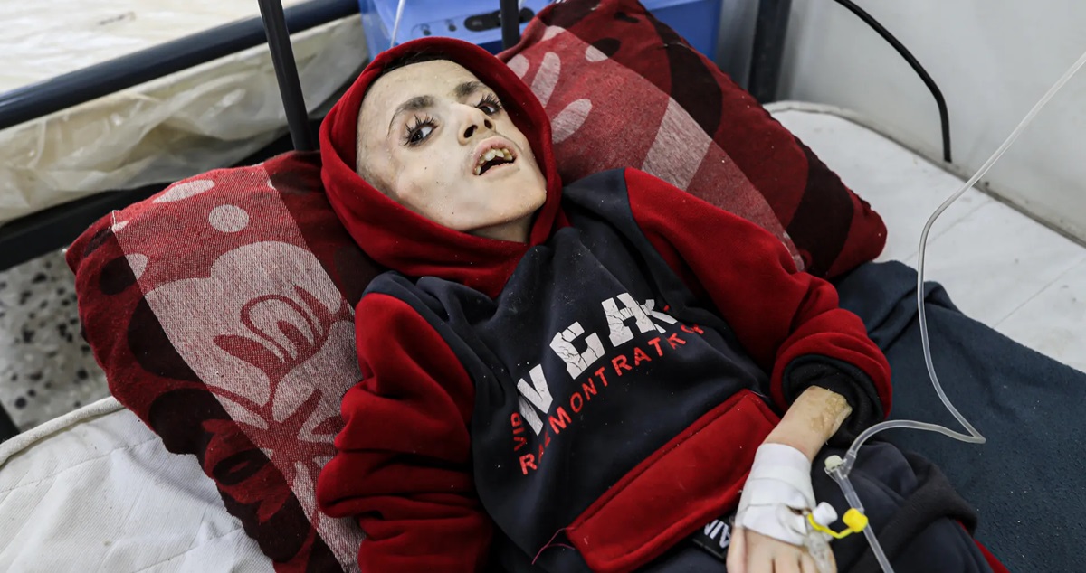 طفل في غزة يرتقي بسبب الجوع 