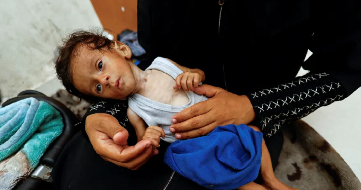 أب مكلوم بغزة قتل الجوع طفله يكابد لإنقاذ بقية الأبناء من الموت