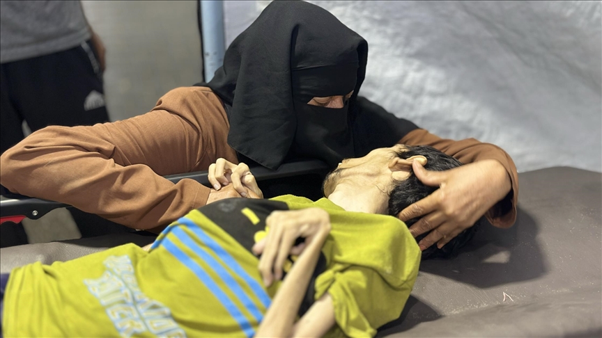 وفاة شاب بسوء التغذية جراء التجويع الاسرائيلي بغزة