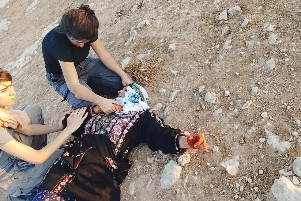 إصابة مواطنين ومتضامنين أجانب في هجوم لمستوطنين على مسافر يطا