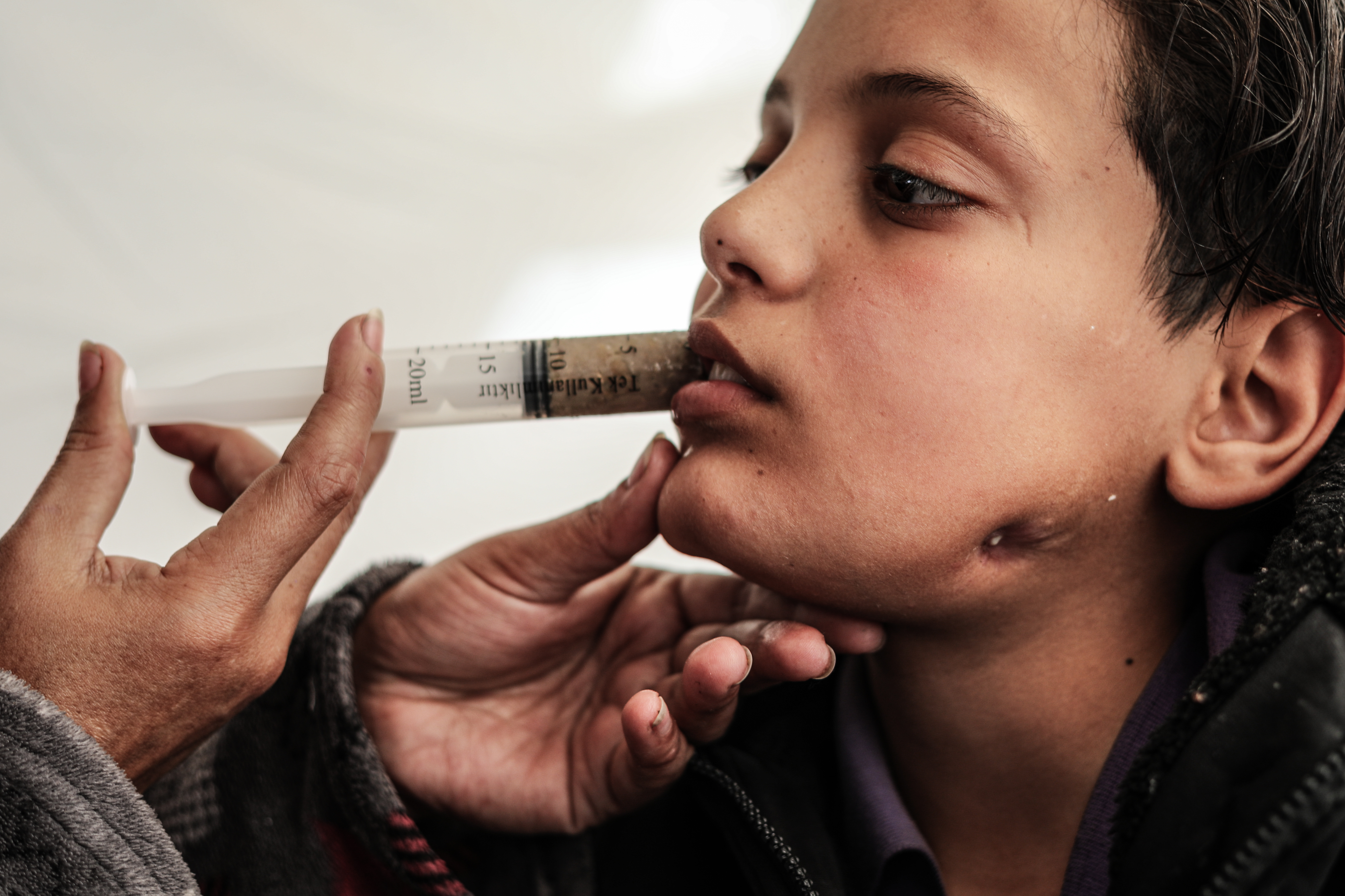 الطفل صهيب المطوق  توجه لجلب الطعام من منطقة زيكيم شمالي القطاع فعاد فاقداً الكلام