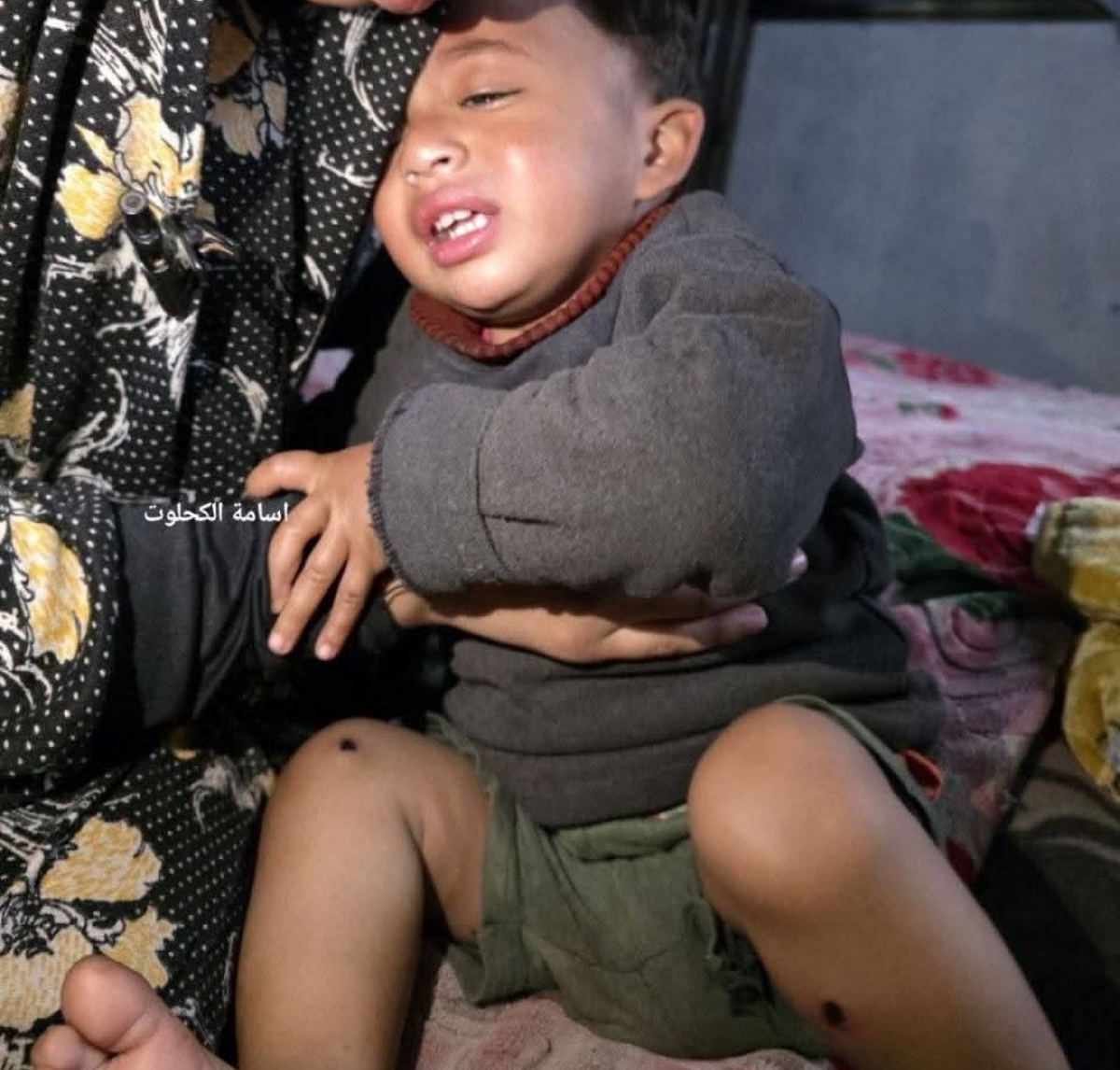 تفاصيل  تعذيب الاحتلال لطفل  في غزة  لم يتجاوز العامين امام والده