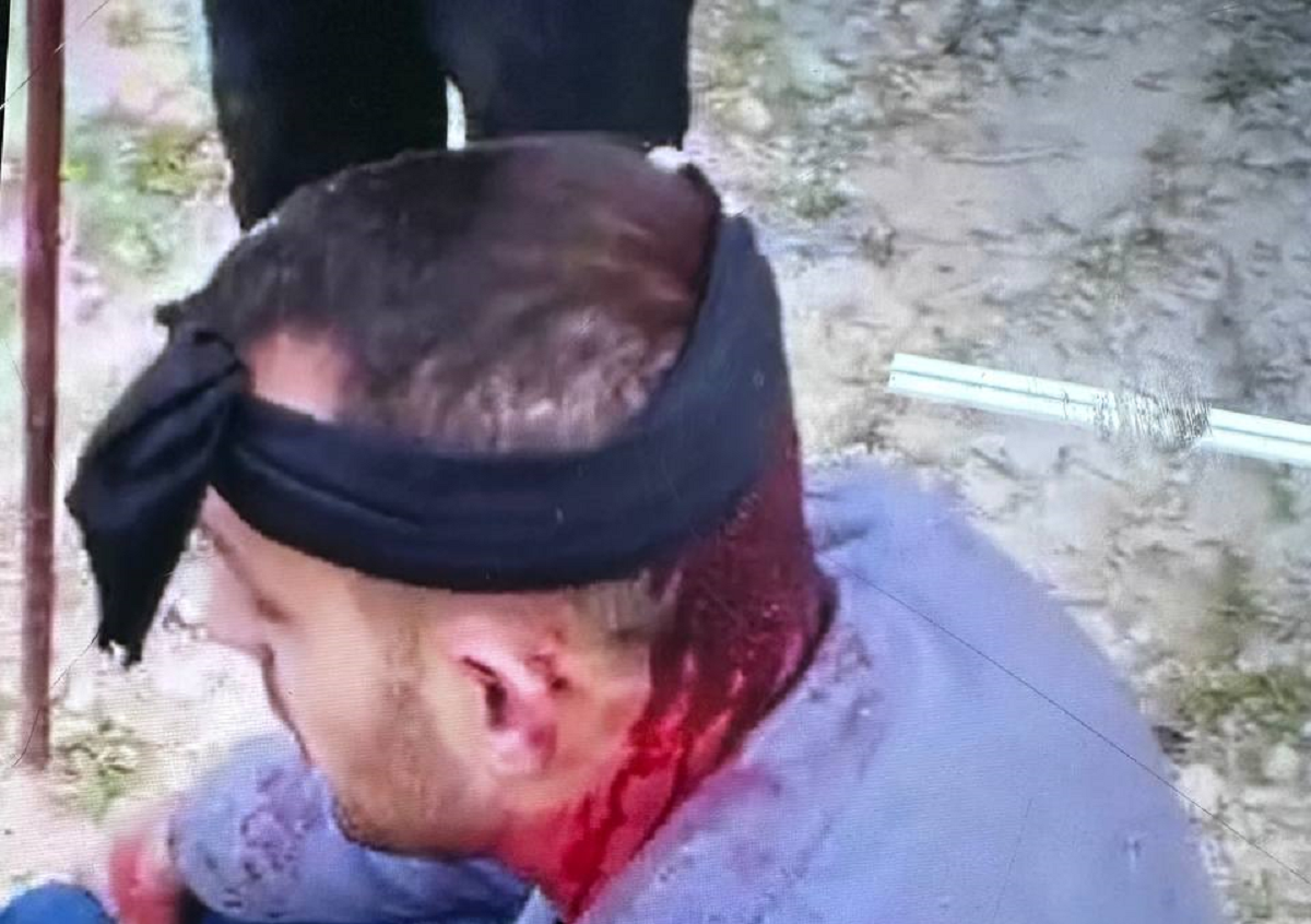 4 إصابات في هجوم للمستوطنين  على منطقة الرأس الأحمر وقصرة  