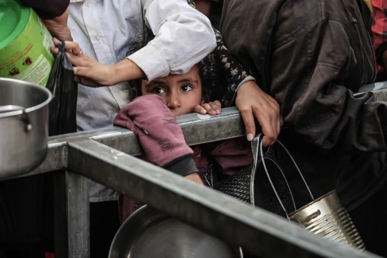 الأونروا: إصابة 508 أطفال في غزة بسوء تغذية حاد